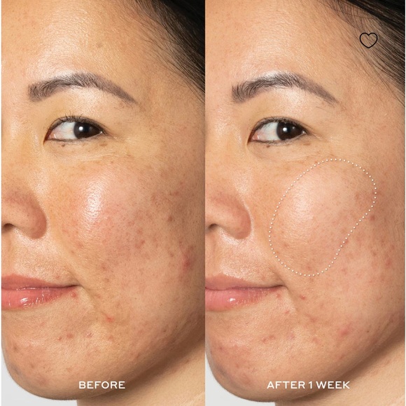 💙🆕💙OLEHENRIKSEN Glow2OH Dark Spot Remover andToner - Picture 9 of 11